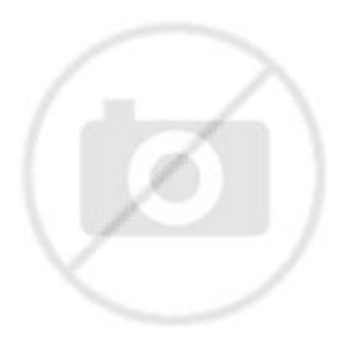 Bertazzoni Range Spark Plug - 415076